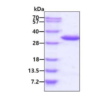 SDS-PAGE Recombinant Human TRPT1 His Protein